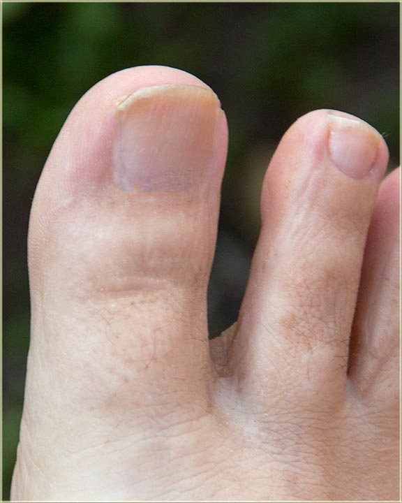 DE PATRU ORI ZECE (de patru or zeće) ?!?