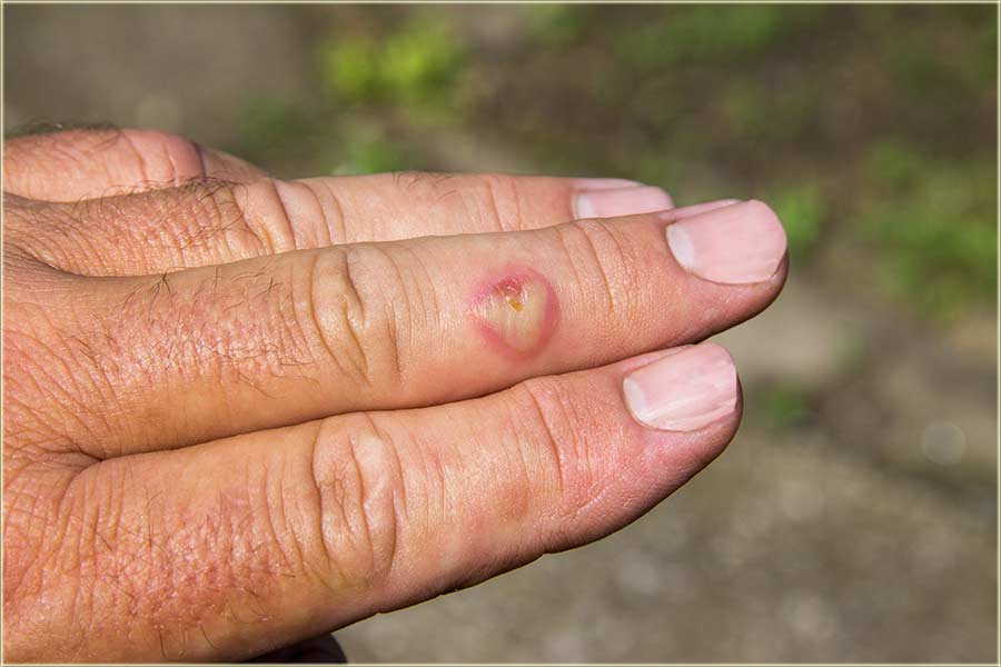 Sve je u obliku srceta...