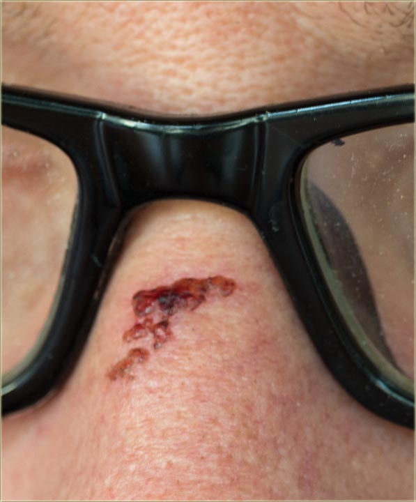 Svi oma vididu, da sam rovašen...